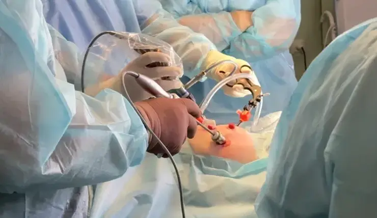 Красноярские медики провели уникальную операцию 10-месячному ребенку с врожденной патологией