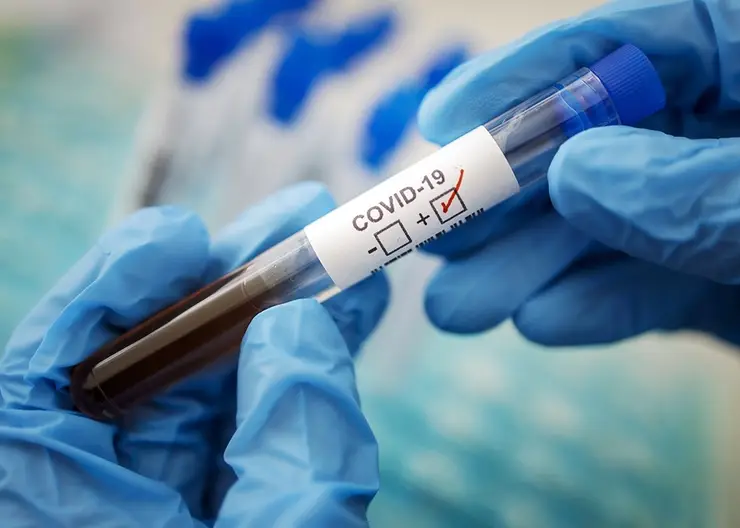 В Красноярском крае у 28 жителей обнаружили коронавирус