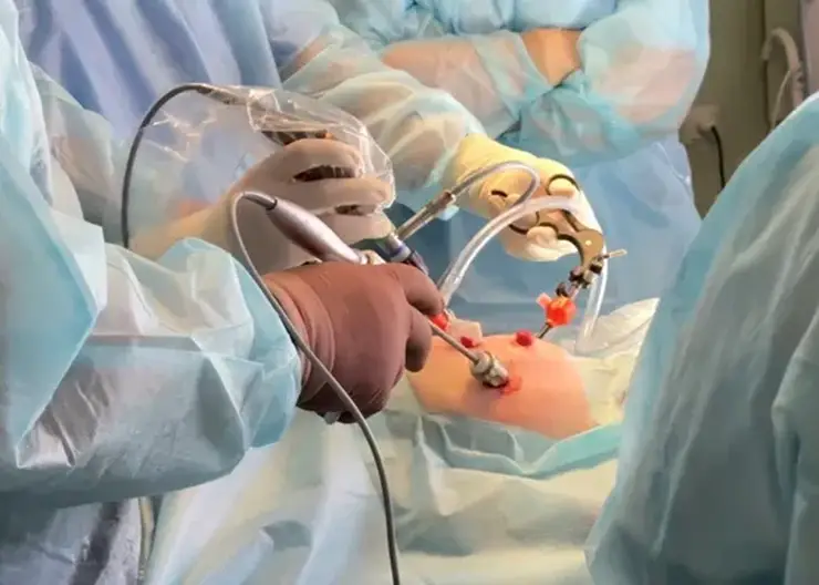 Красноярские медики провели уникальную операцию 10-месячному ребенку с врожденной патологией