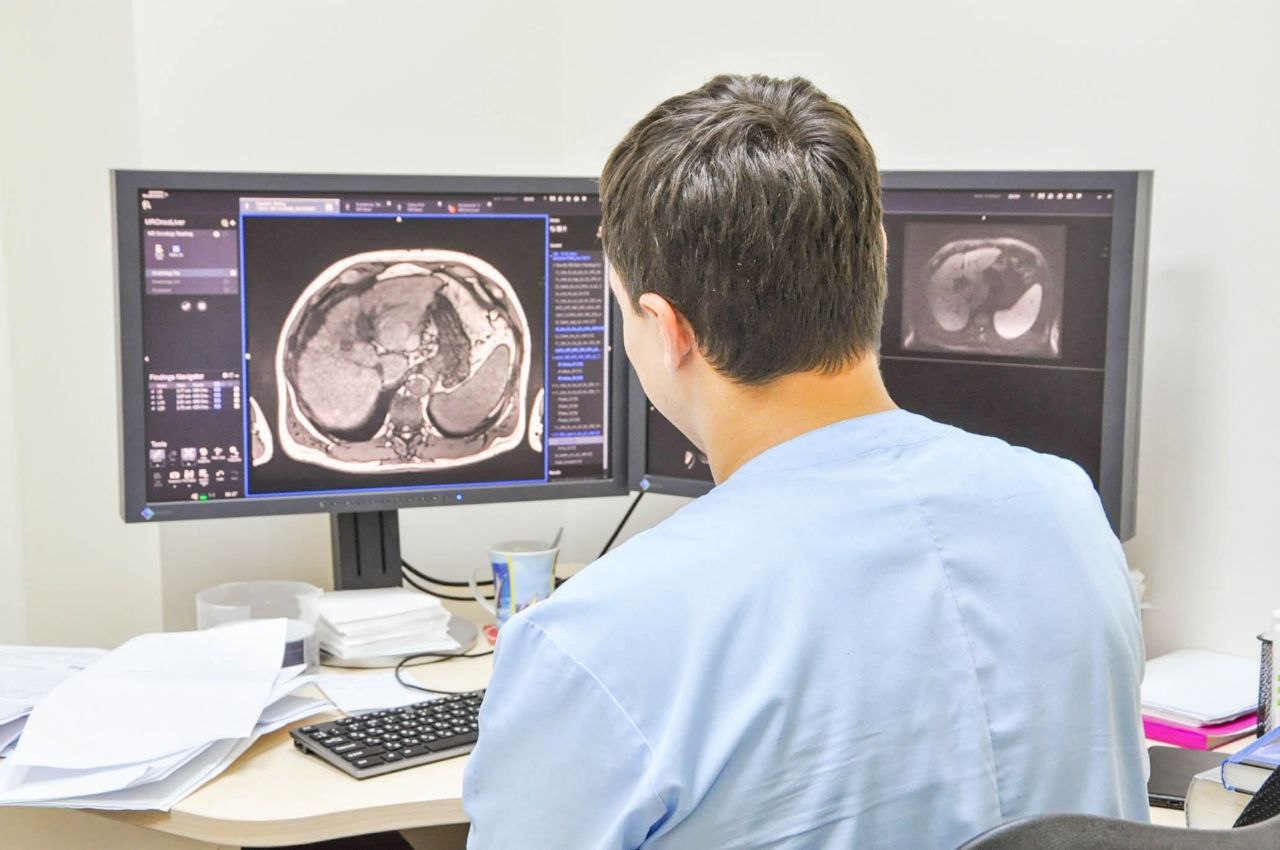 В Красноярске пациенты из группы риска проходят обследования для раннего выявления рака печени